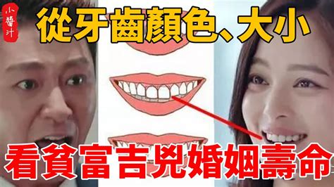 牙齒相學|牙齒看你一生財運、富貴、婚姻